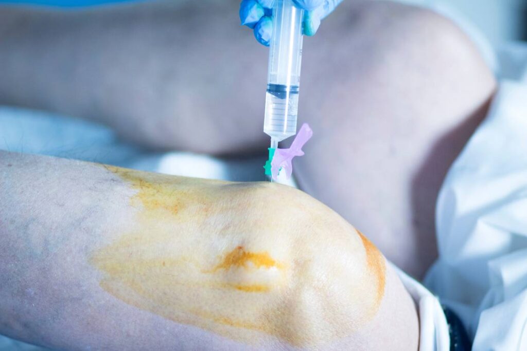 фото коліна на операції