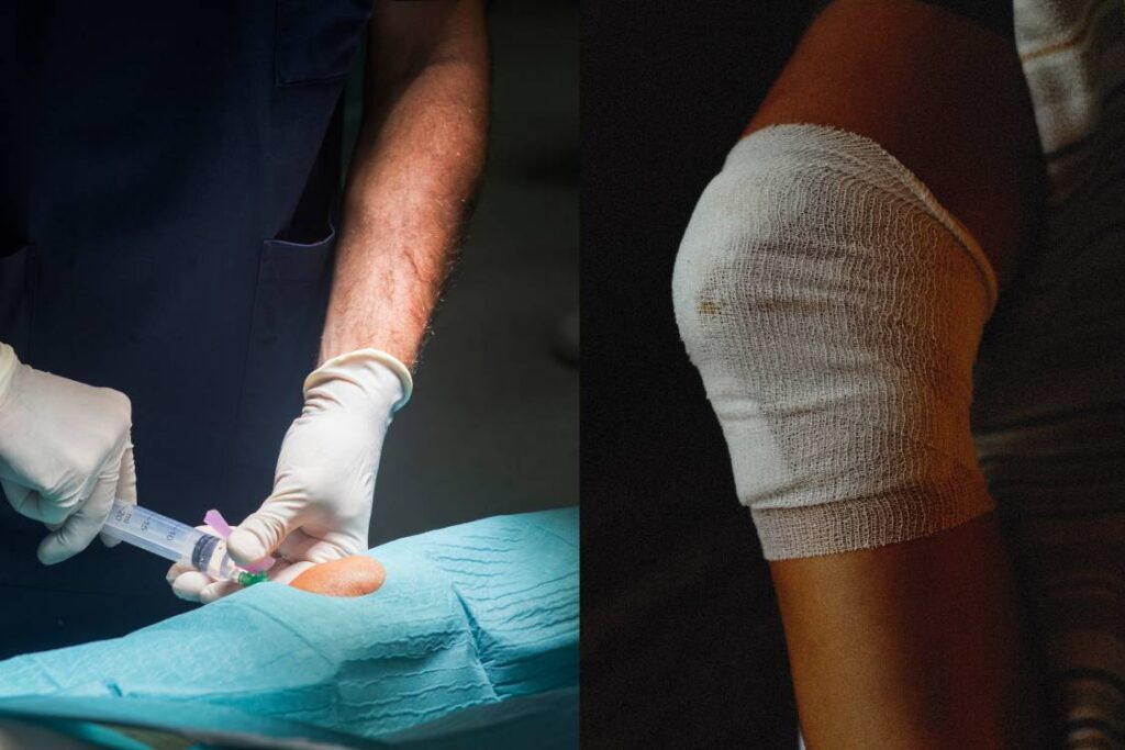 фото перевязаного коліна